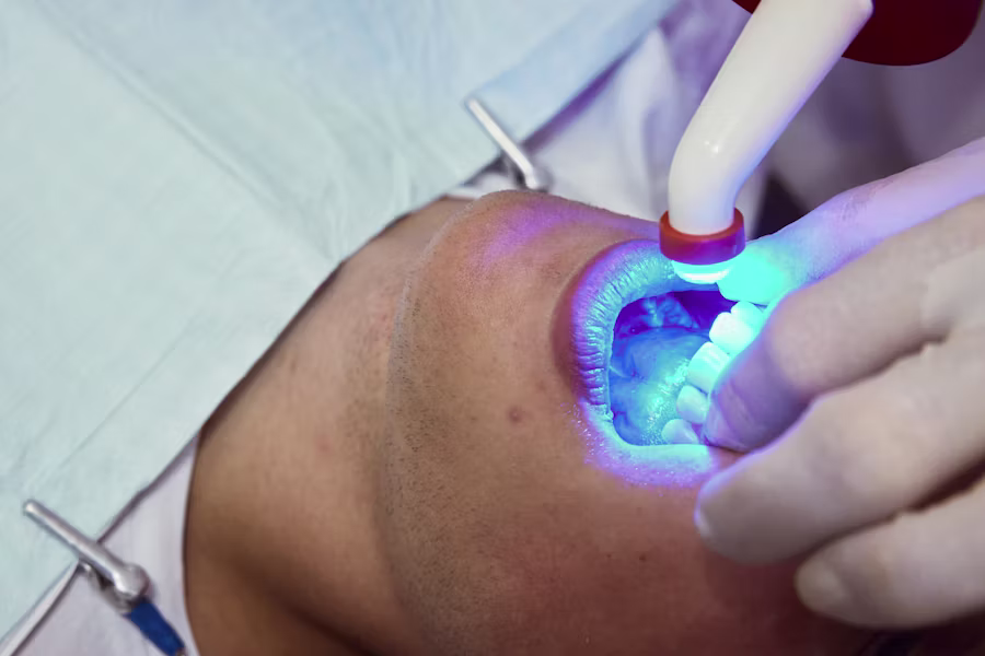 Sbiancamento denti professionale in studio — Studio Odontoiatrico Dott. Enrico Martini